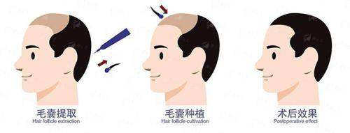 <strong>二、扬州景区安与医疗美容诊所特色项目介绍</strong>