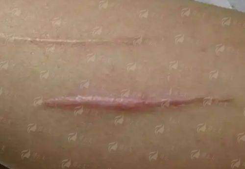 <strong style="color:red;">二、上海华美整形美容医院李志海隆胸手术项目</strong>