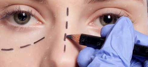 二、广州番大中医医院鼻部整形口碑如何？