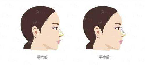 <strong>二、常州星范柏菲特色医美项目推荐</strong>