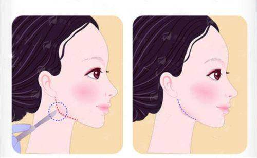 长春中妍奥拉克究竟好不好？医生实力大曝光，预约通道速来