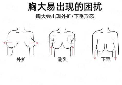 三、彭才学医生眼底脂肪重置的技术优势