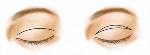 <strong>四、真实实例见证成效</strong>