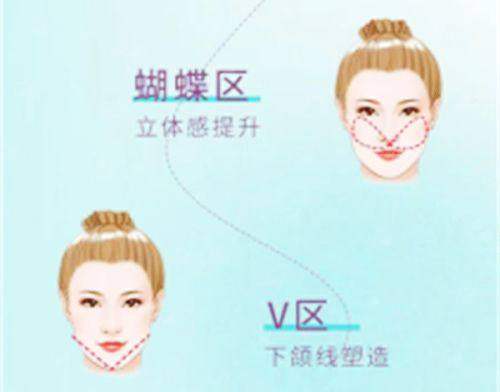 六、眼底脂肪重置手术流程