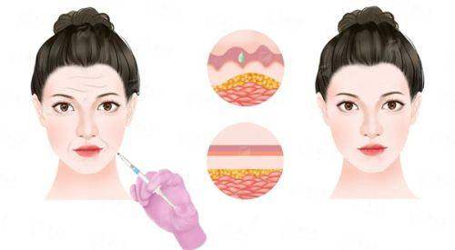 <strong style="color:red;">四、如何选择上海华美整形美容医院李志海隆胸手术？</strong>