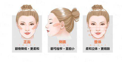 二、长春中妍奥拉克医学美容医院王牌项目解析