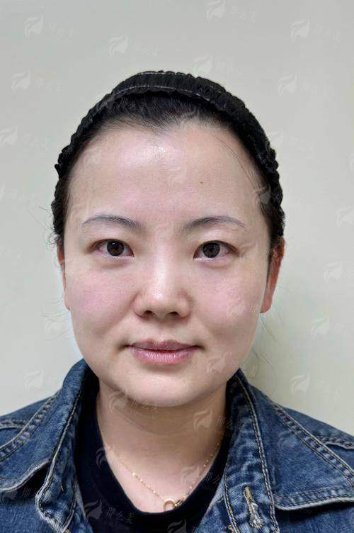 秦其斐医生鼻部整形技术好吗？广州番大中医医院口碑+预约方式