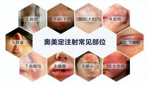 谭臻田隆胸技术靠谱吗？沈阳元辰整形医院医生特色+术后效果对比看