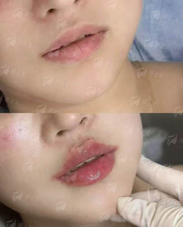 <strong>六、扬州景区安与医疗美容诊所服务特色</strong>