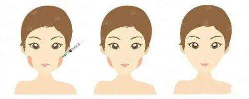 南昌韩美美容医院做双眼皮靠谱吗？双眼皮技术如何？有什么优势？