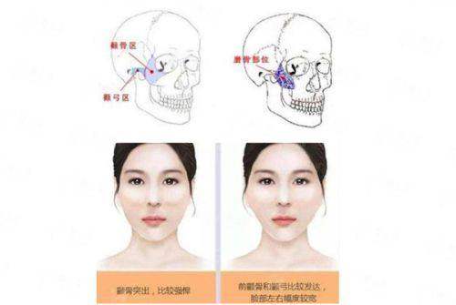 <strong>二、南昌佳美美容医院双眼皮技术如何？</strong>