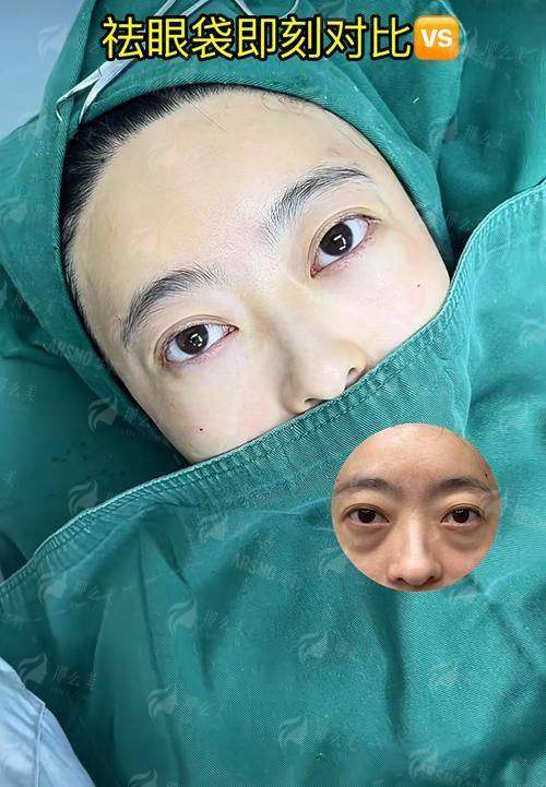 四、如何预约徐州和平妇产医院祛眼袋？