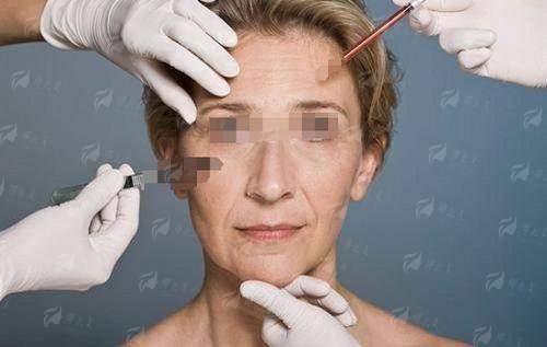 四、郑州喜丽小切口拉皮术后要注意啥？修复期指南