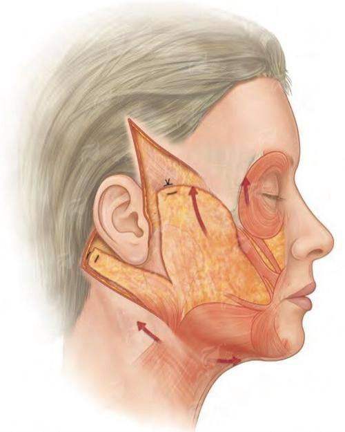 郑州喜丽小切口拉皮做的自然吗？价格、恢复期、医生技术全公开！