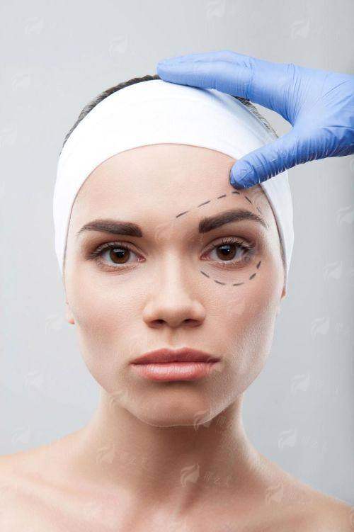 二、郑州喜丽小切口拉皮医生技术靠谱吗？关键看这三点