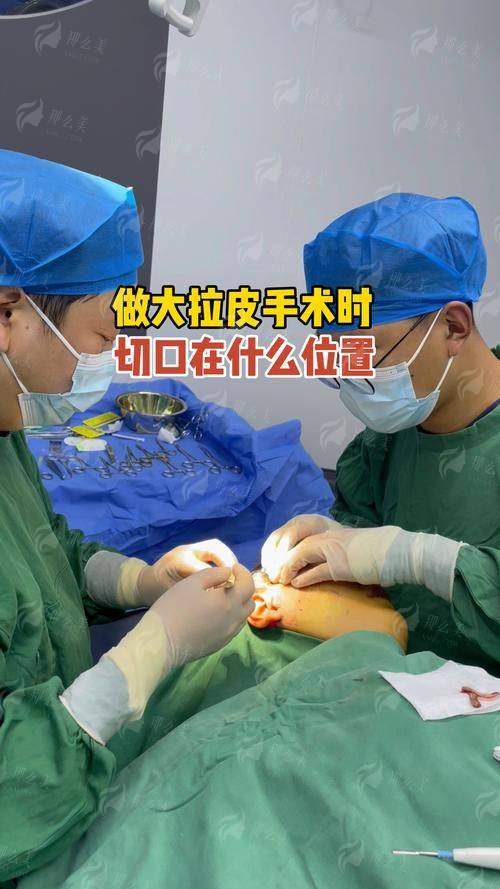 三、邯郸莱媚俪整形医院的拉皮手术成效能维持多久？