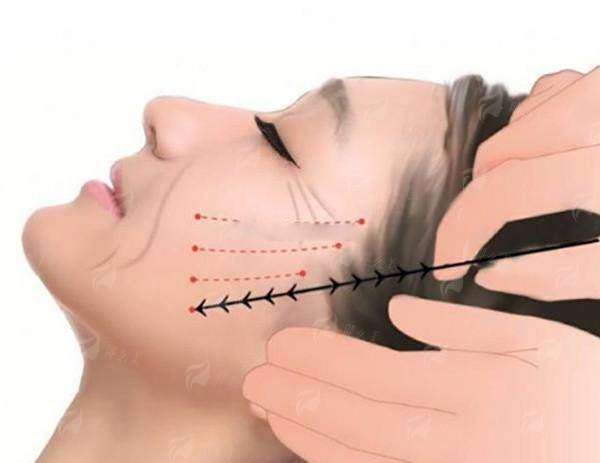 五、为什么选择北京黄寺医疗美容门诊部徐永成博士?