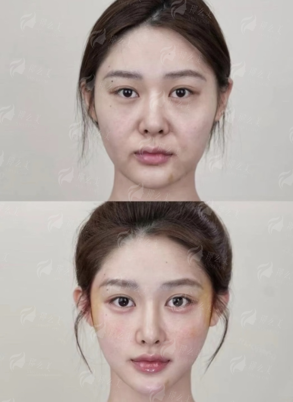 <strong>三、南昌诺颜医疗美容做双眼皮有什么优势？</strong>