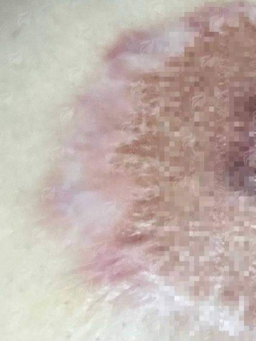 四、昆明隆胸医院怎么预约？实地考察建议