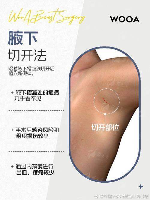 二、昆明隆胸价格大公开！5家医院收费对比