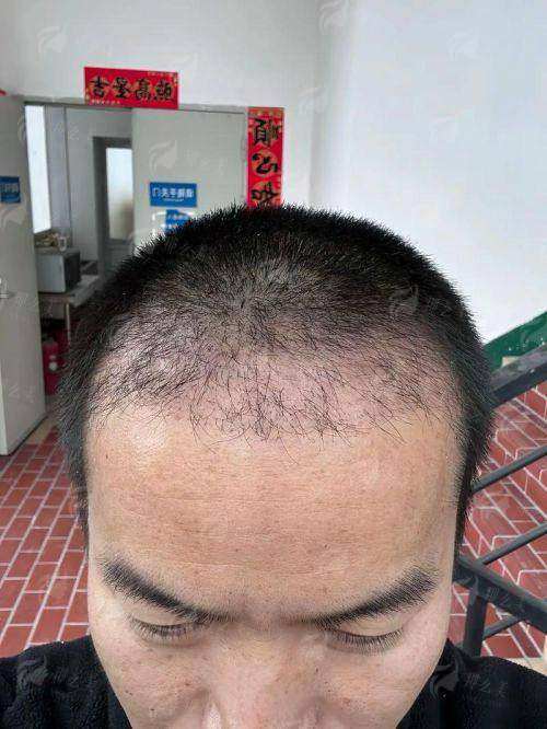 四、哈尔滨臻美全身吸脂多少钱？怎么预约？