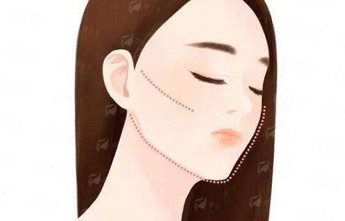 重庆米兰柏羽时光有啥独特魅力？案例了解、价格分析，附24小时预约挂号攻略！