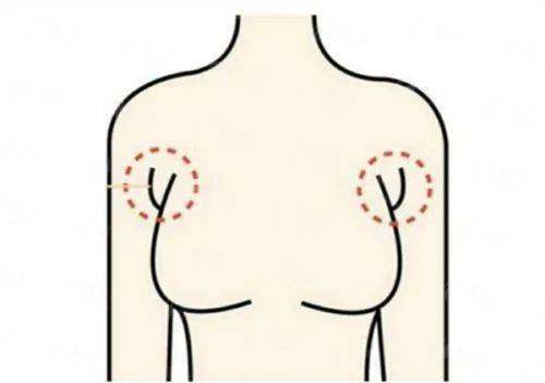 <strong>二、广州海峡医疗美容医院周红英坐诊时间安排</strong>