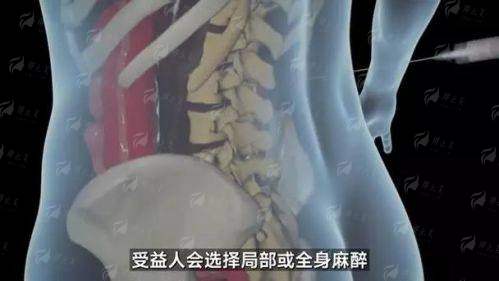 四、如何预约兰州时光激光整形医院逯岩隆胸？