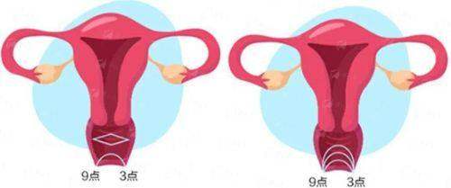 四、如何预约江苏张家港康丽医院的阴道紧缩手术？