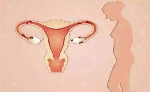 三、江苏张家港康丽医院阴道紧缩成效如何？术后要注意什么？