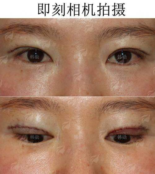 六、手术价格及增值服务