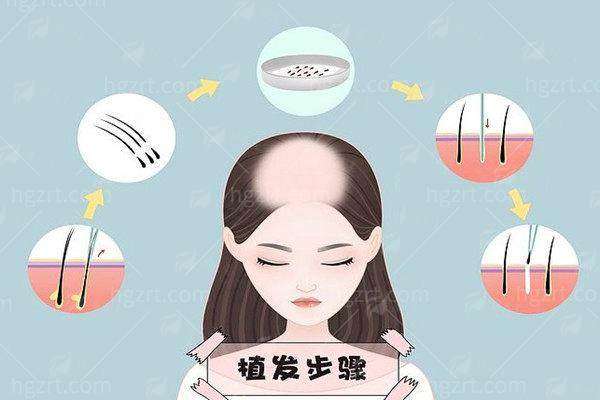 四、郑州华仁植发怎么预约？地址在哪？