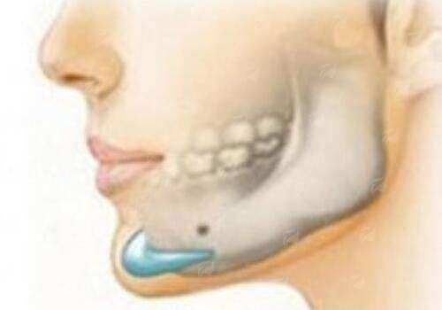 四、如何预约杜如意医生双眼皮手术?超全指南!