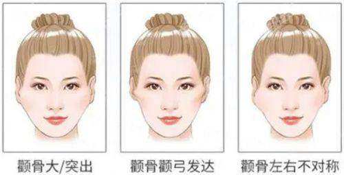 三、郑州芊美整形杜如意医生双眼皮价格贵不贵?