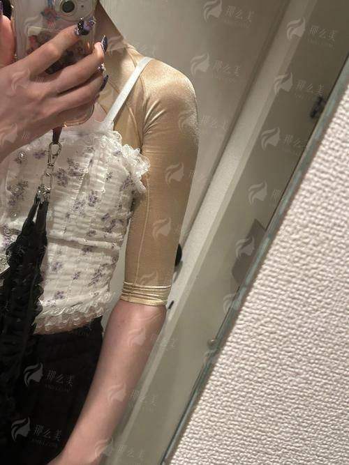 三、连云港媚眼整形手臂环吸价格了解！同城项目对比