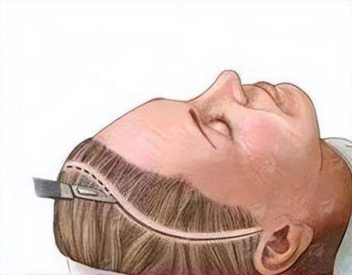 <strong>四、如何预约潍坊华韩整形的切开双眼皮手术？</strong>