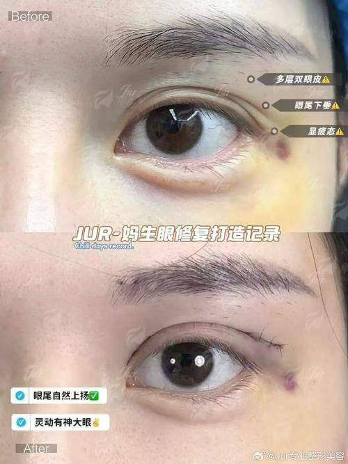 四、梅州市半岛医疗美容怎么预约？实地考察建议