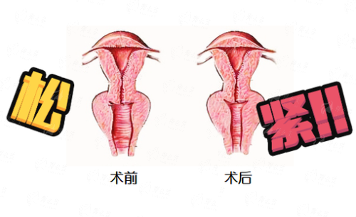 惠州惠城友禾私密科阴道紧缩，医院介绍+特色技术，预约开启紧致之旅！