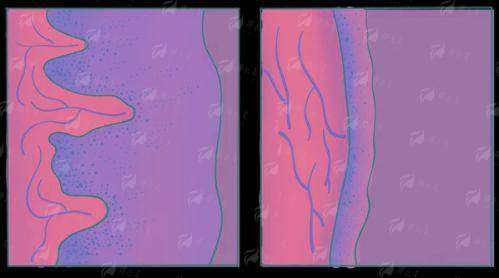 二、北京新星靓做阴道紧缩术有哪些优势？