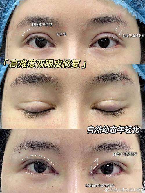 一、广东韩妃整形外科医院李猷医生资质解析