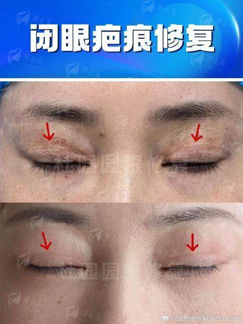 三、广东韩妃医院真实患者实例反馈