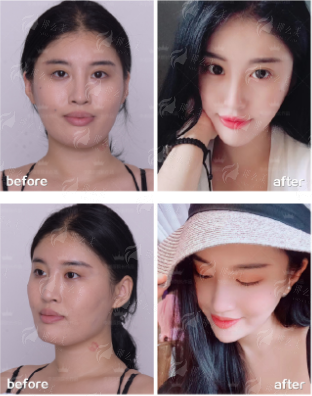 二、上海伊莱美整形医院做腹壁整形环境如何？