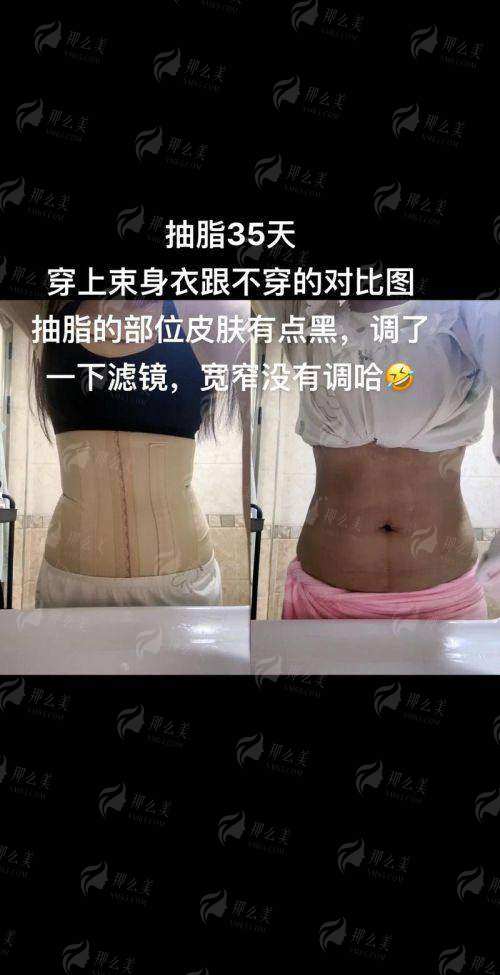 上海韩卓医疗美容祛眼袋案例推荐，价格了解+预约方式，新颜智尚一键搞定！