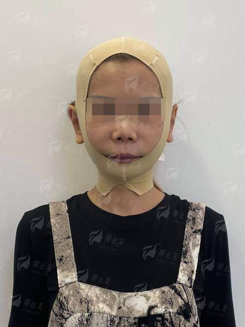 乌鲁木齐慧美拉皮手术约起来！了解价格优惠攻略，点击一键预约开启焕颜之旅