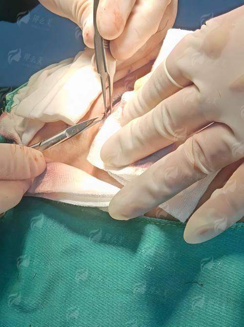 四、如何预约乌鲁木齐慧美的拉皮手术?