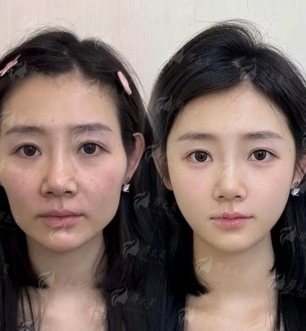 广州建国医院私密整形科预约揭秘！新颜智尚一键预约，解决排队久痛点，正确路径让你省心变美，预约方式大公开 