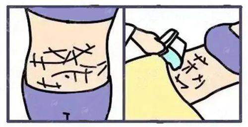 四、真实实例分享：见证水光补水的神奇成效