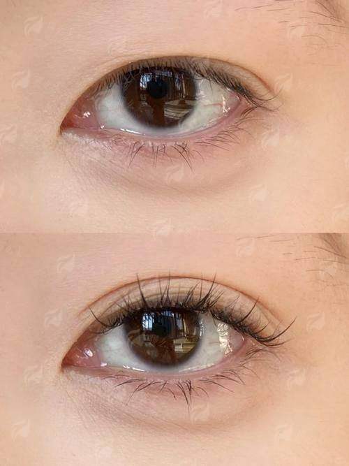 三、河南郑州整形美容鲁华医生坐诊信息