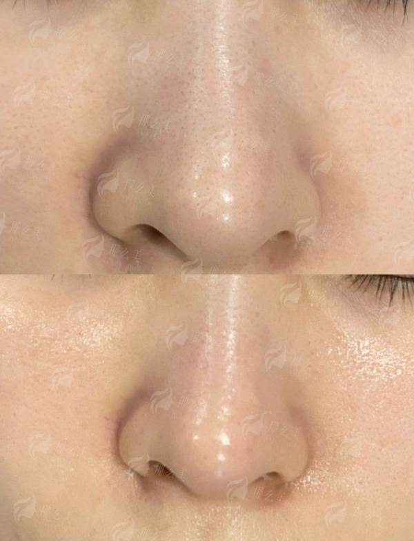 三、重庆地区同类项目对比怎么选？