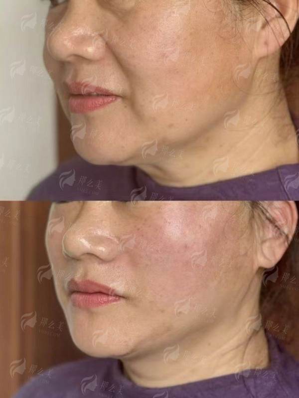 二、重庆长良医疗美容做光影轻龄术有哪些优势？